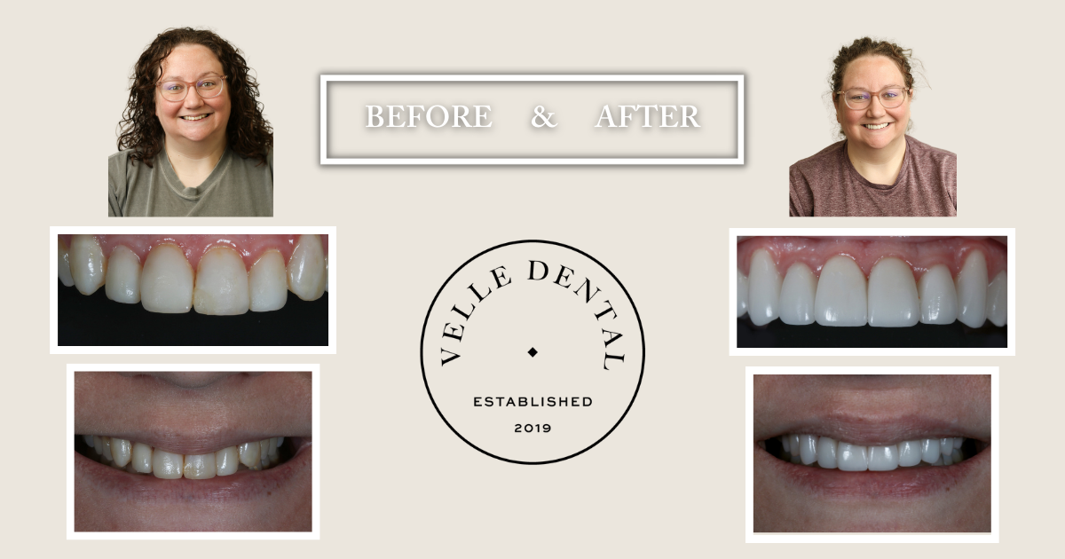 Bartish UPDATED solo image May 23 Blog